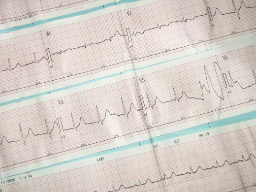 Hyperkalemie: zvládnutelná komplikace antihypertenzní léčby