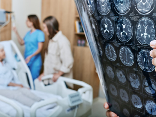 Léčba Alzheimerovy nemoci zůstává velkou výzvou